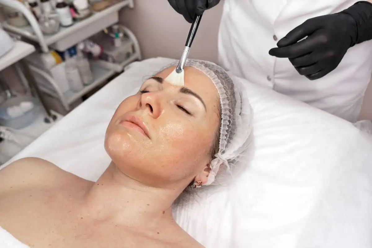 Chemical Peels by Skincare Sommelier Beauty Lab & Med Spa in Forest Hills NY