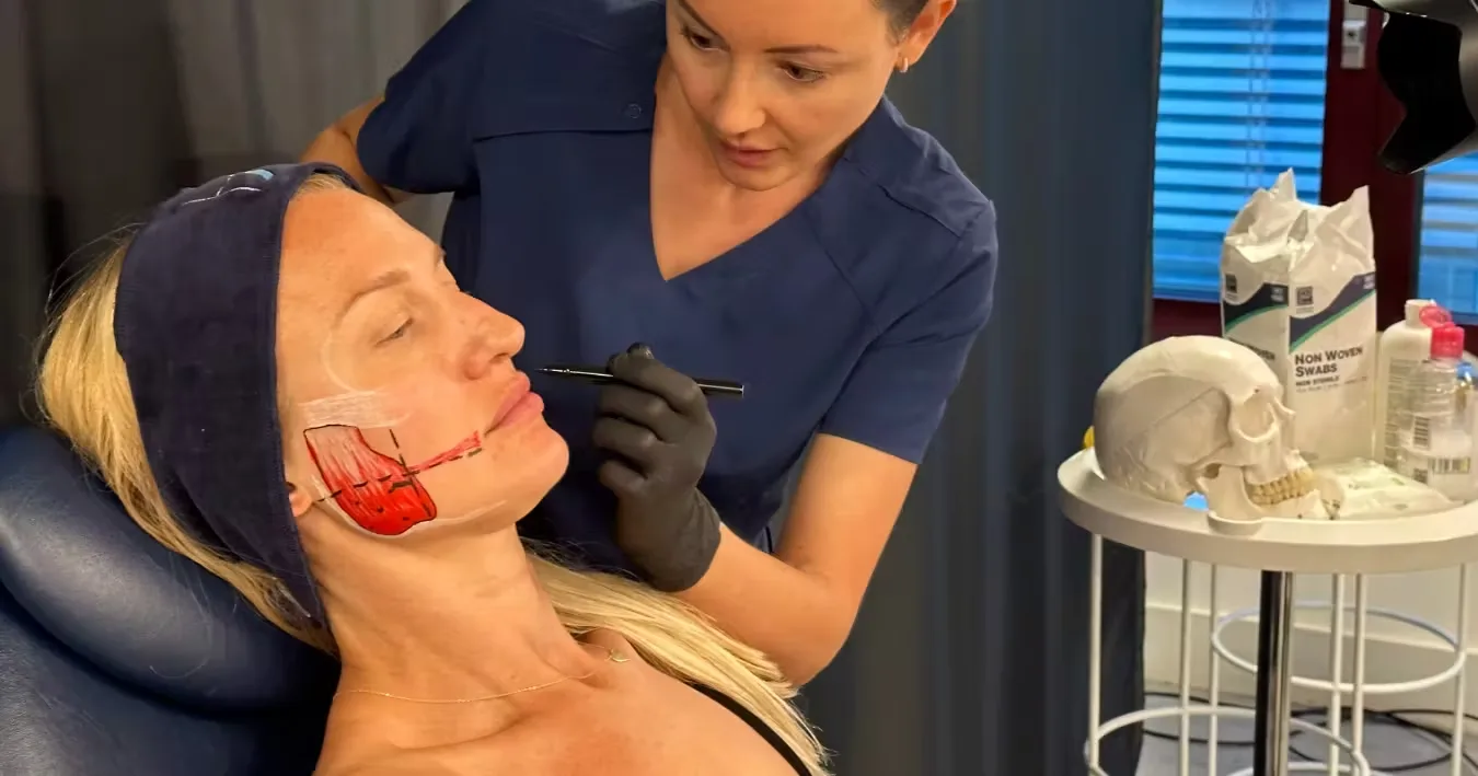 How long does masseter botox last?
