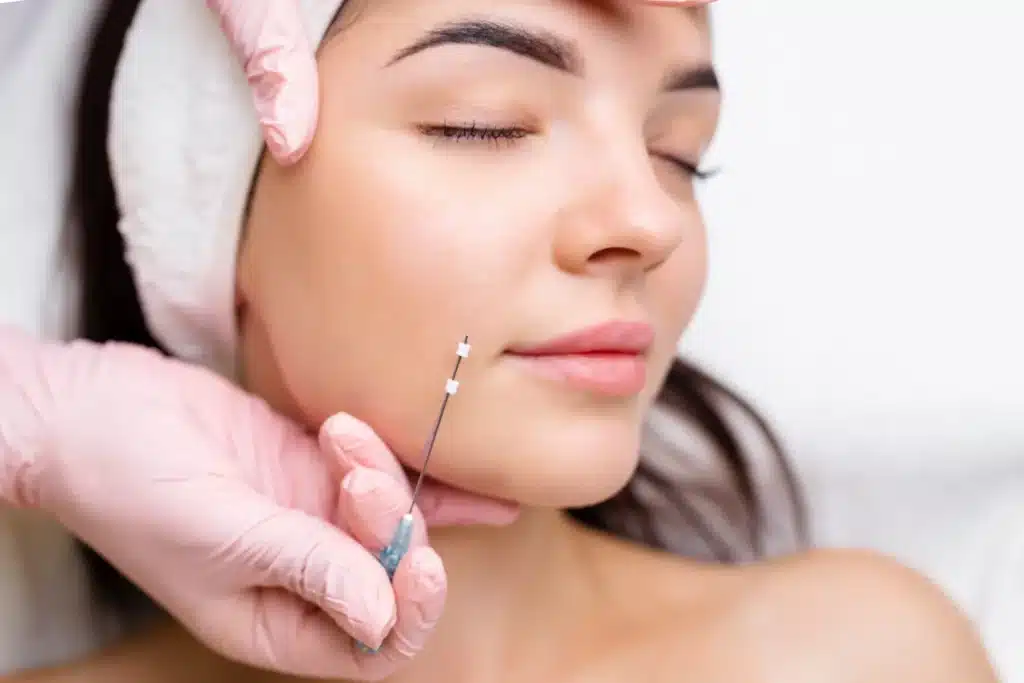 Myskinsommelier | Threadlift Services in Forest Hills