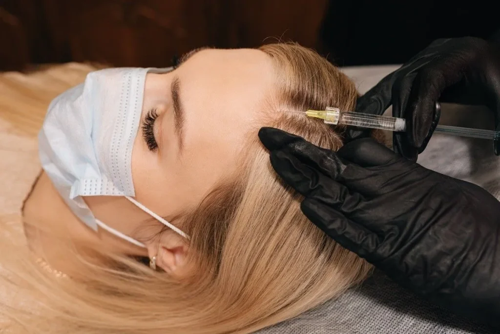 Woman receiving PRP injection in scalp for hair restoration treatment in Forest Hills, NY