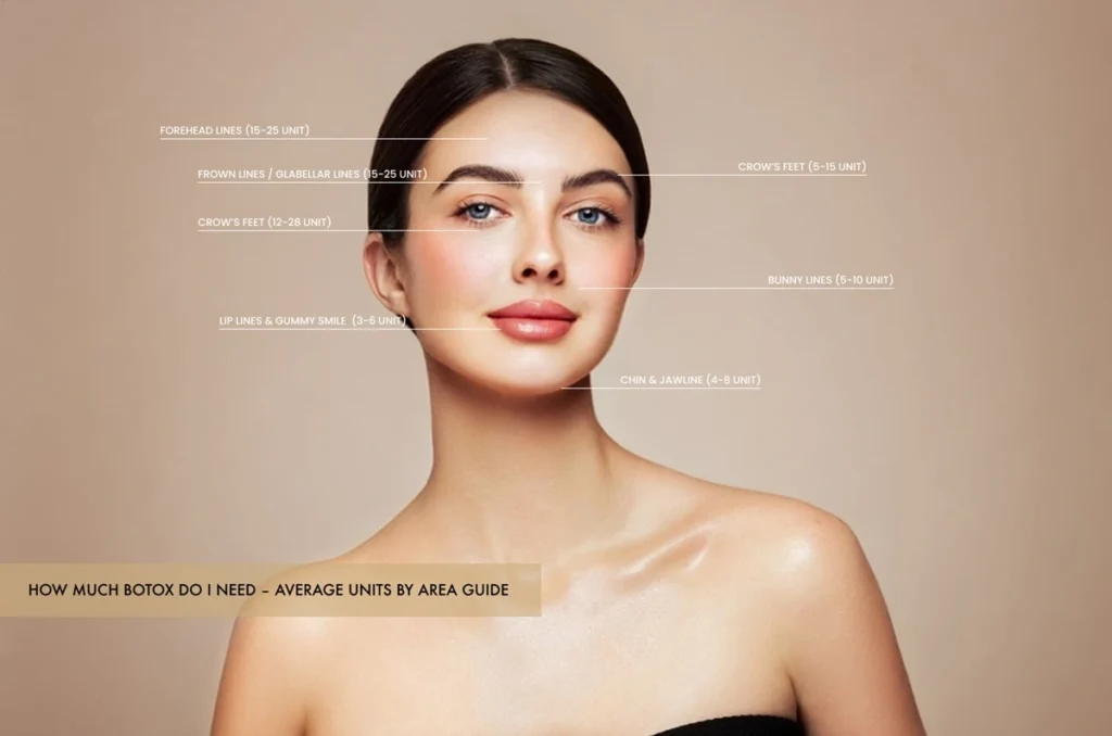 How Much Botox Do I Need: forehead, glabella, crow’s feet units chart
