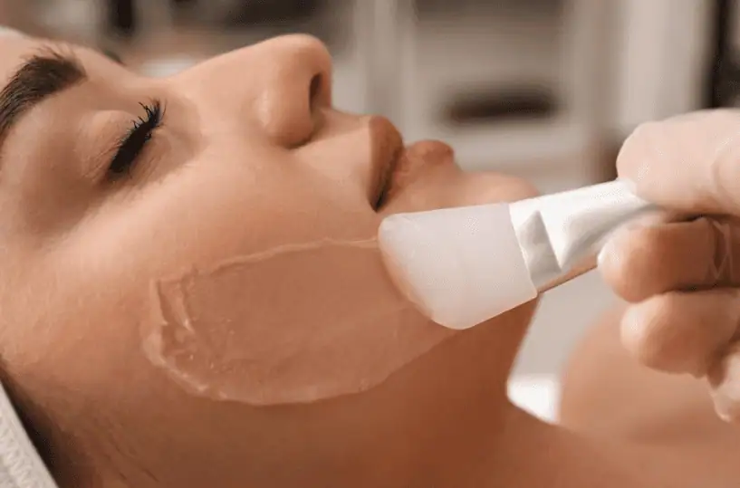 chemical peel facial near me