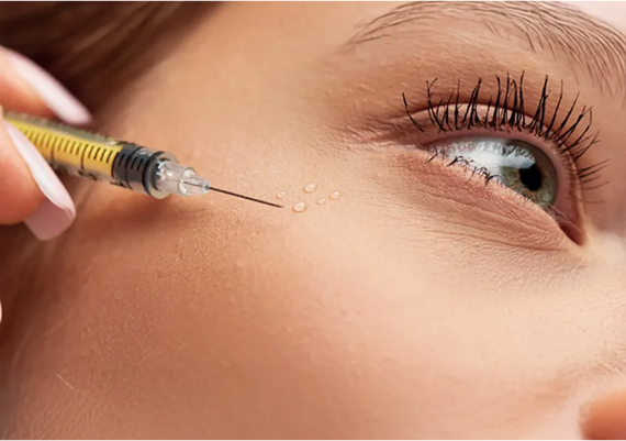 Client during PRF facial rejuvenation at Sommelier Beauty Lab