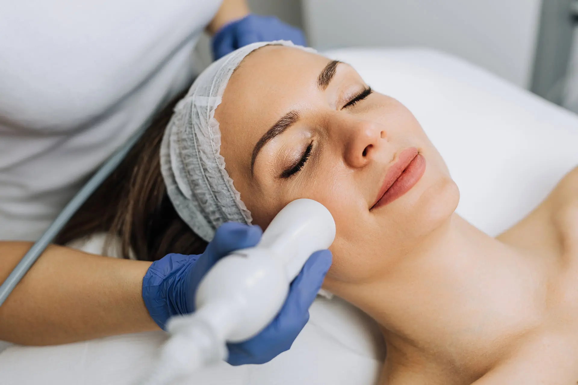 rf microneedling near me