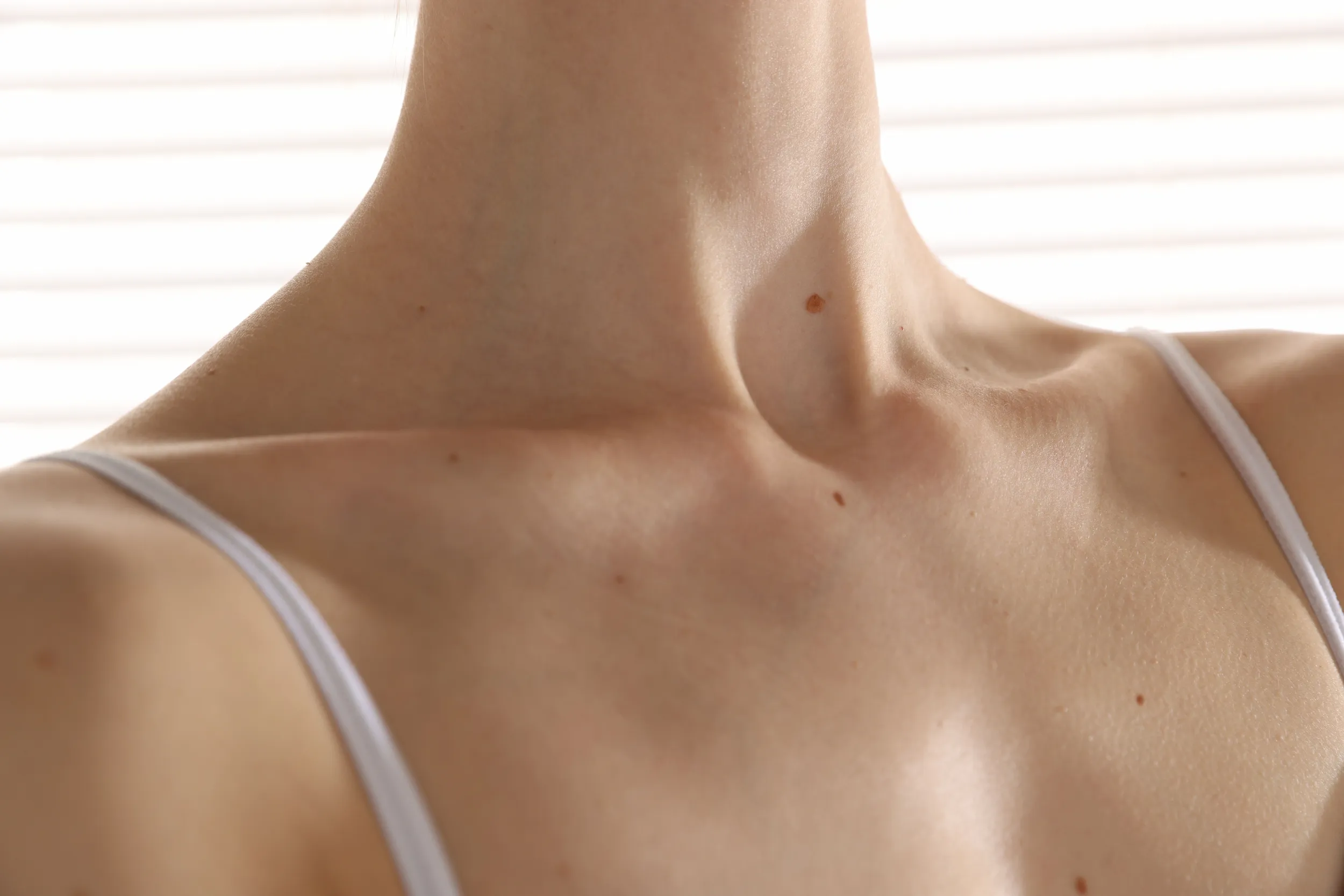 Woman's neck treated with Sculptra biostimulator showing firmer, smoother skin