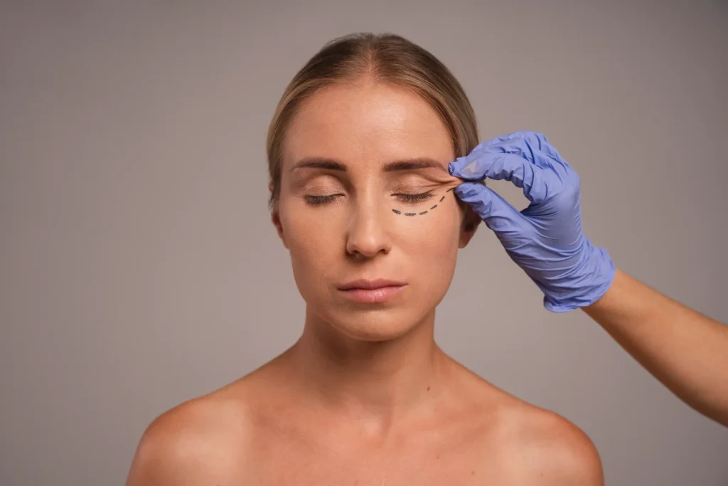 Dermal fillers for under eye hollows Queens.