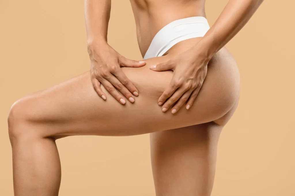 A woman examining her leg skin texture, illustrating how many sessions are needed to reduce cellulite with Endospheres.