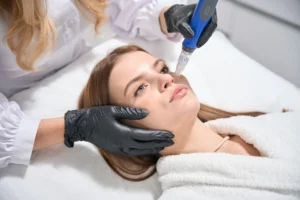 A woman receiving a safe and professional summer microneedling treatment at Skincare Sommelier in Forest Hills, Queens.