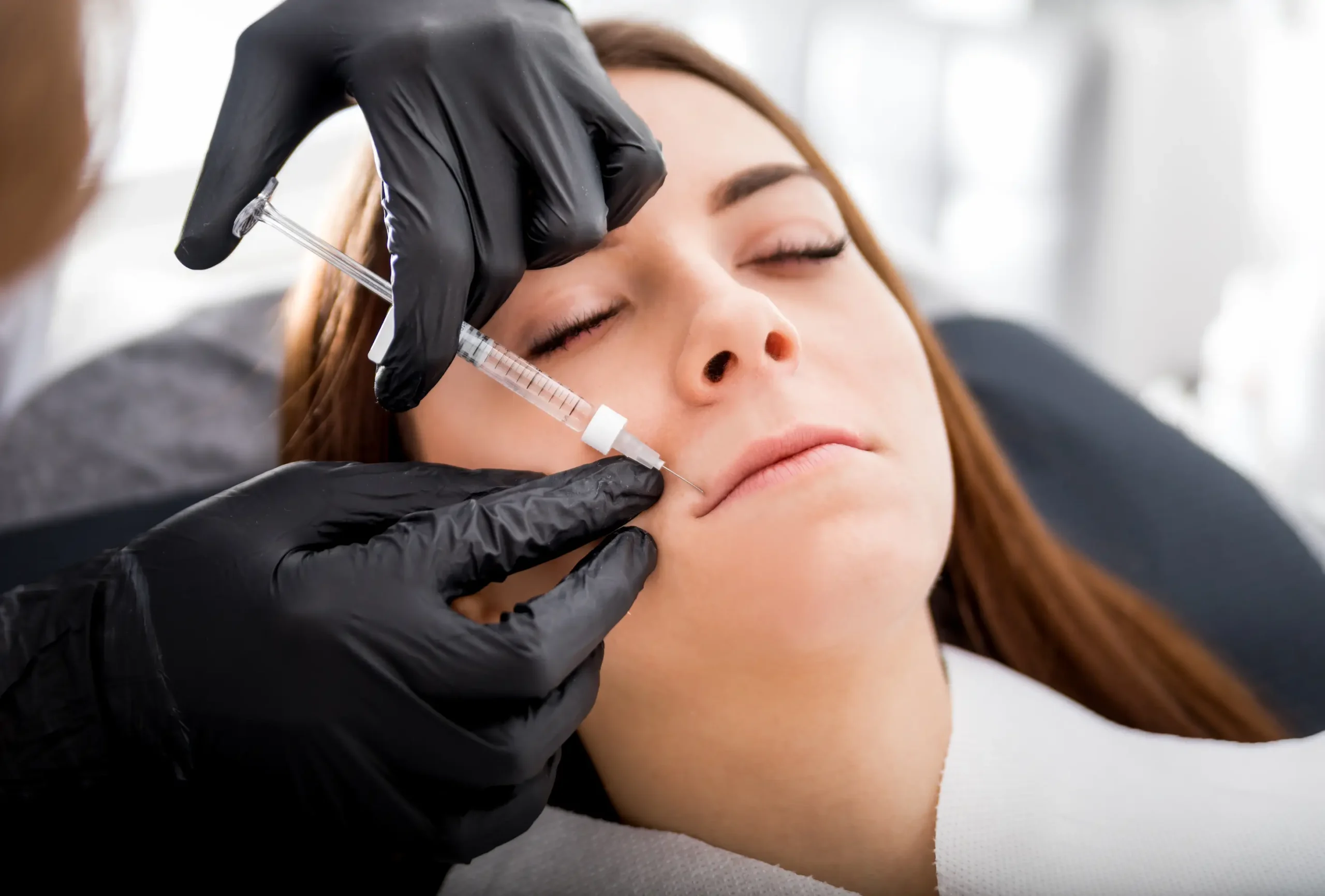 A client with thin lips receiving precise Russian lip filler injections at Skincare Sommelier Beauty Lab & Med Spa in NYC.