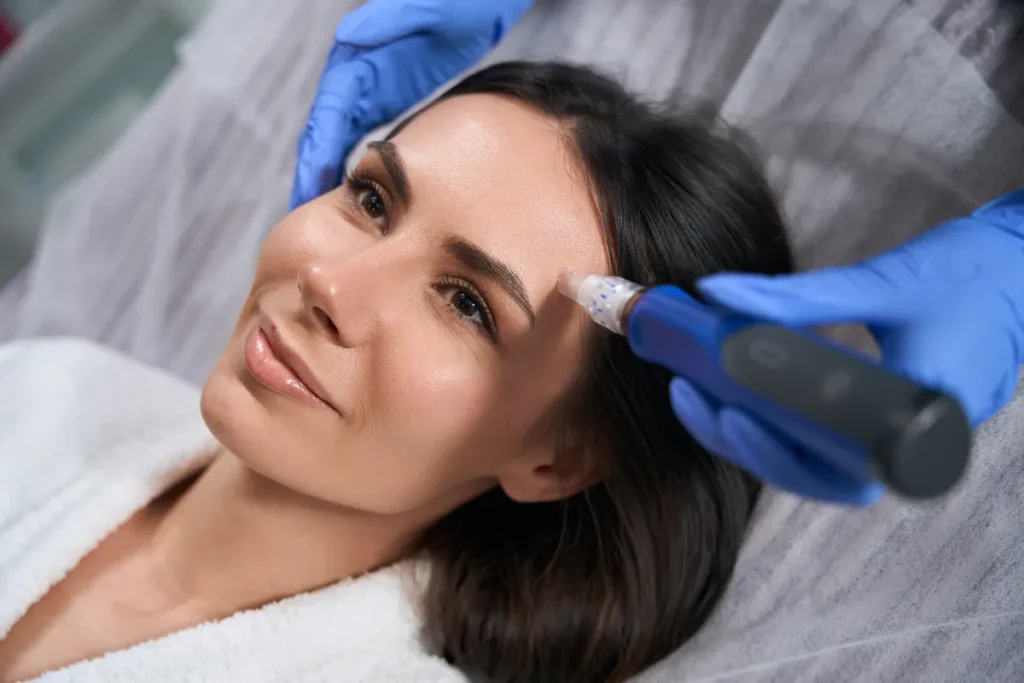 Woman receiving microneedling treatment on forehead at a Forest Hills skincare clinic