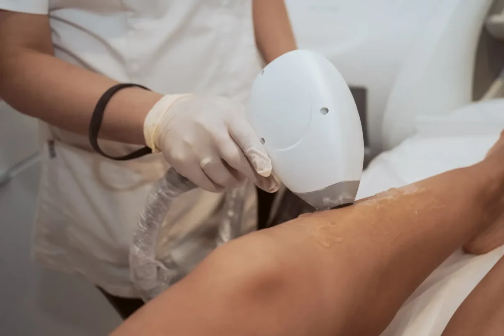 Laser hair removal treatment on a client's legs during a session at Skincare Sommelier, NYC.