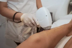 Laser hair removal treatment on a client's legs during a session at Skincare Sommelier, NYC.