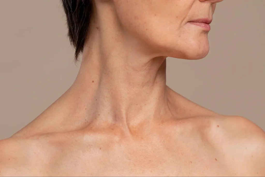 Close-up of a woman's neck and jawline showing loose skin and volume loss after GLP-1 weight loss